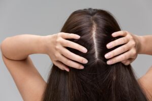 Healthy Hair Follicles