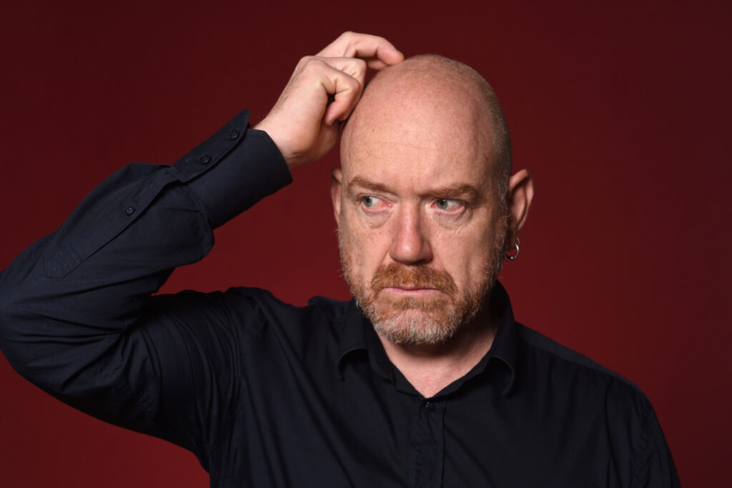 A man scratching his head for having shaved head dandruff