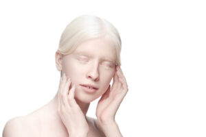 Pigmentation Disorders: Albinism